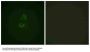 Anti-Vinculin VCL Antibody