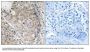 Anti-MKP-1/2 DUSP1 Antibody