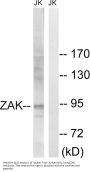 Anti-ZAK zak2 Antibody
