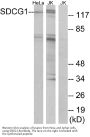Anti-SDCG1 Antibody