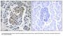 Anti-MtSSB SSBP1 Antibody