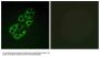Anti-MtSSB SSBP1 Antibody