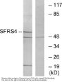 Anti-SFRS4 Antibody
