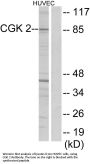 Anti-CGK 2 Antibody