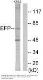 Anti-ZNF147 TRIM25 Antibody