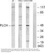 Anti-PLCH GPAT3 Antibody