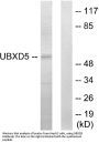 Anti-UBXD5 Antibody
