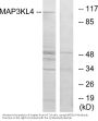 Anti-MAP3KL4 MAP3K21 Antibody