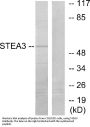 Anti-STEA3 Antibody
