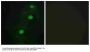 Anti-CCRK CDK20 Antibody