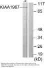 Anti-KIAA1967 CCAR2 Antibody