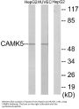 Anti-CAMK5 CAMKV Antibody