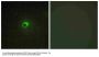 Anti-ACTR-1C Antibody