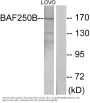Anti-BAF250B ARID1B Antibody