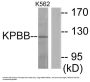 Anti-KPBB PHKB Antibody