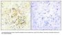 Anti-TMEPA PMEPA1 Antibody