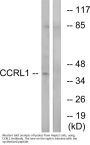 Anti-CCRL1 Antibody