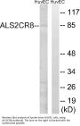 Anti-ALS2CR8 Antibody