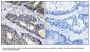 Anti-GLB1L3 Antibody