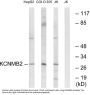 Anti-KCNMB2 Antibody