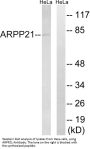 Anti-ARPP21 Antibody
