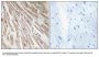 Anti-ARPP21 Antibody