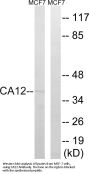 Anti-CA12/Ca Xii Antibody