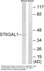 Anti-ST6GAL1/Cd75 Antibody