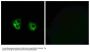 Anti-MARCH2 MARCH2; Antibody