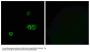Anti-MARCH5 MARCH5; Antibody