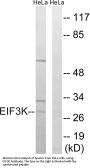 Anti-EIF3K Antibody
