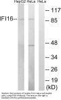 Anti-IFI16 Antibody