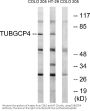 Anti-TUBGCP4/Gcp4 Antibody