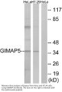 Anti-GIMAP5 Antibody
