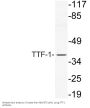 Anti-TTF-1 NKX2-1 Antibody