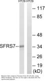 Anti-SFRS7 Antibody
