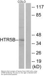 Anti-HTR5B Antibody