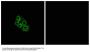 Anti-LSHR Antibody