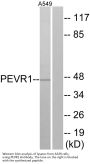 Anti-PEVR1 Antibody