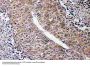Anti-CTPS Antibody
