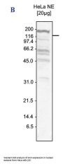 Anti-Ski3 TTC37 Antibody