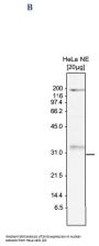 Anti-Ski8 WDR61 Antibody