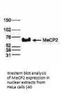 Anti-Methyl-CpG-binding protein 2 MeCP2 Antibody