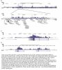 Anti-H4K20me3 HIST1H4A Antibody
