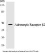 Adrenergic Receptor beta2 Colorimetric Cell-Based ELISA Kit