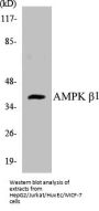 AMPK beta1 Colorimetric Cell-Based ELISA Kit