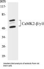 CaMK2-beta/gamma/delta Colorimetric Cell-Based ELISA Kit