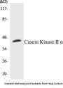 Casein Kinase II alpha Colorimetric Cell-Based ELISA Kit