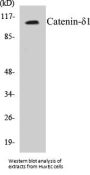 Catenin-delta1 Colorimetric Cell-Based ELISA Kit
