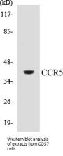 CCR5 Colorimetric Cell-Based ELISA Kit